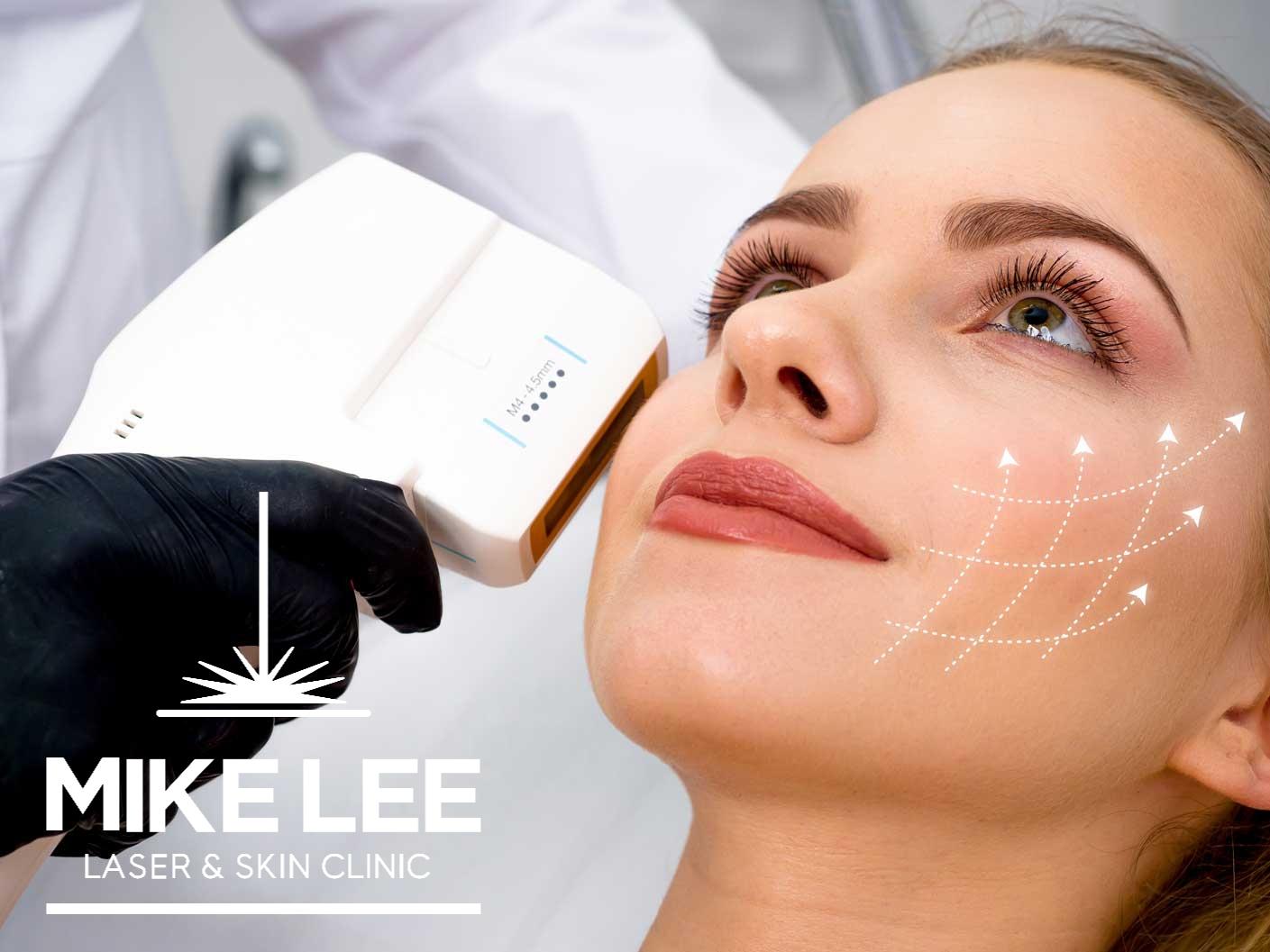 HIFU Skin Tightening at Mike Lee Laser & Skin Clinic