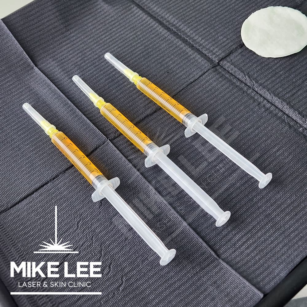 P-Therapy (for ED) at Mike Lee Laser & Skin Clinic