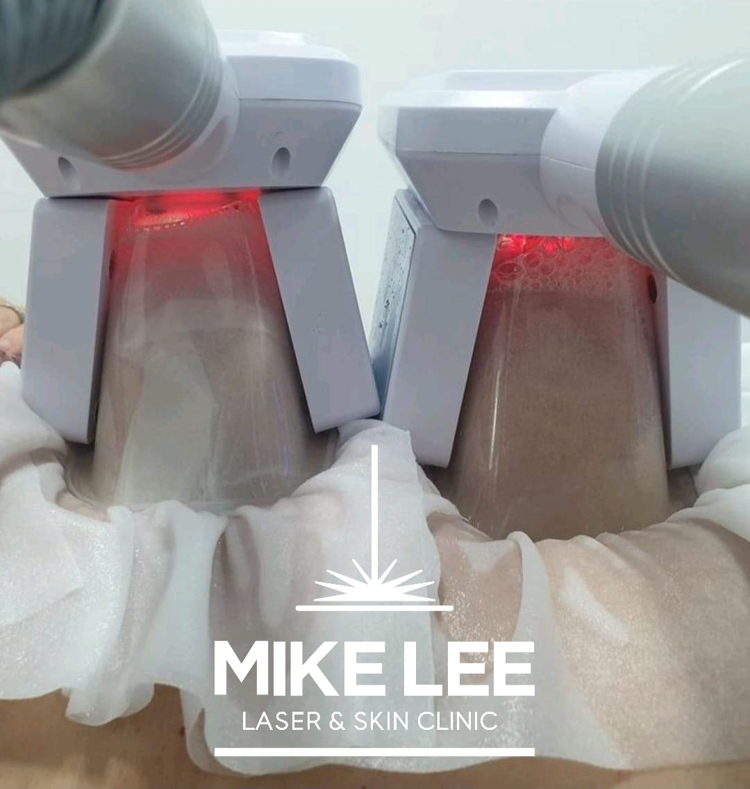 Cryolipolysis (Fat Freezing) at Mike Lee Laser & Skin Clinic